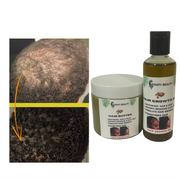 Hair Growth Oil & Hair Growth Butter Duo  Best Oil & Butter For Hair Growth